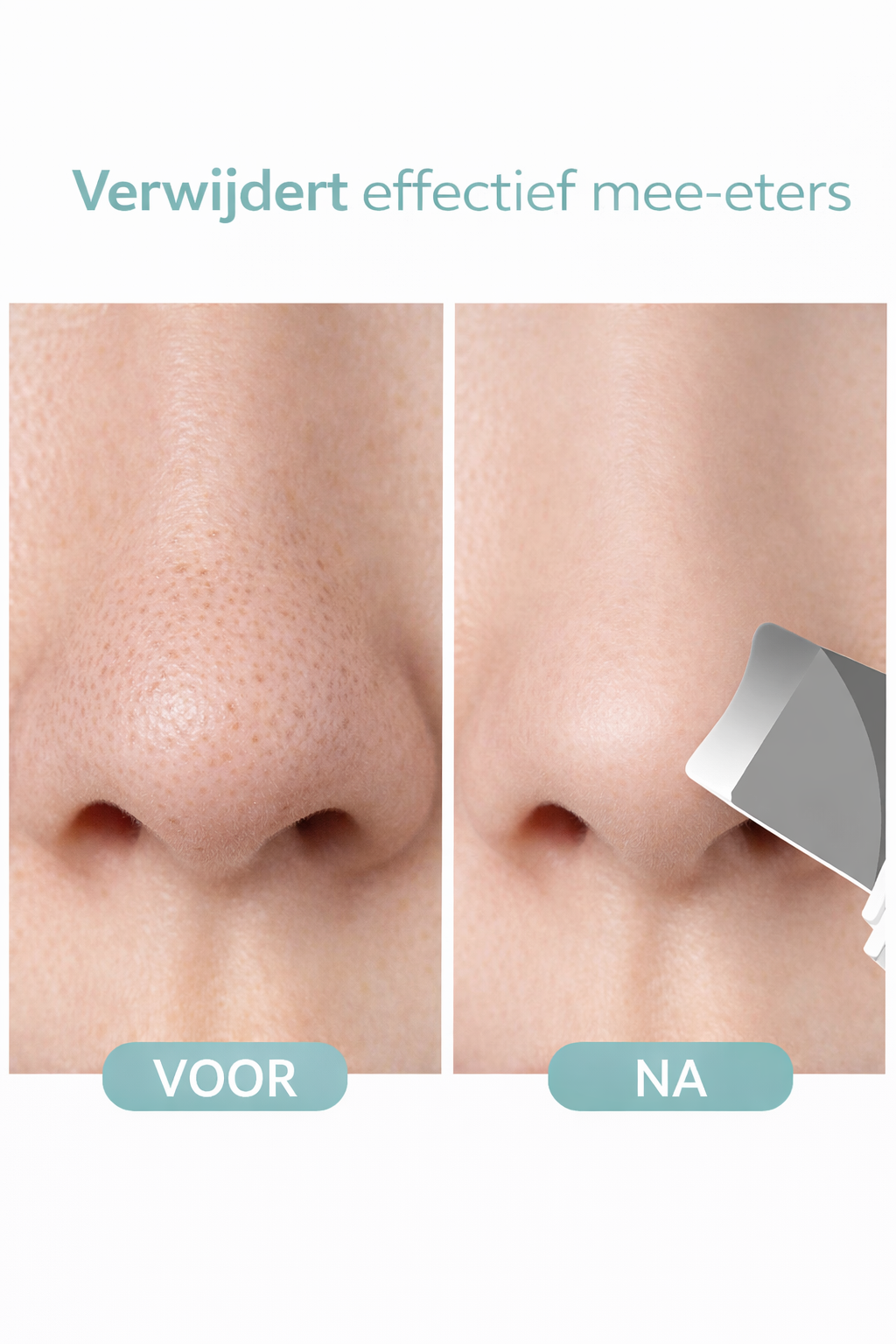 Elvora SkinClear Scrubber